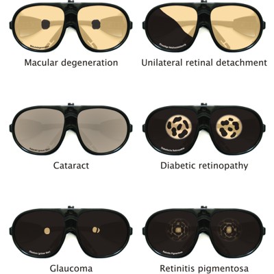 Simualtion glasses simulating 6 eye diseases